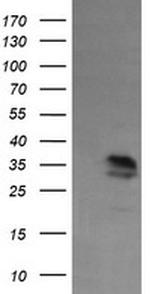 KIF25 Antibody in Western Blot (WB)