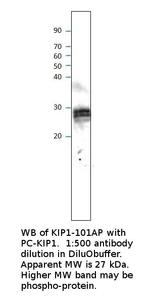 p27 KIP1 Antibody in Western Blot (WB)