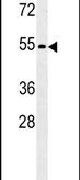 KLF17 Antibody in Western Blot (WB)