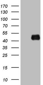 KLF2 Antibody in Western Blot (WB)