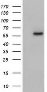 KLHL2 Antibody in Western Blot (WB)