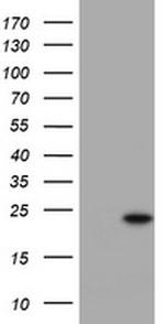 KRAS Antibody in Western Blot (WB)