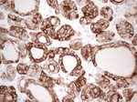 KRT16 Antibody in Immunohistochemistry (Paraffin) (IHC (P))