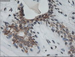 KRT18 Antibody in Immunohistochemistry (Paraffin) (IHC (P))