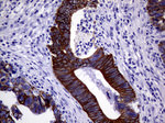 KRT18 Antibody in Immunohistochemistry (Paraffin) (IHC (P))