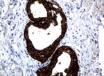 KRT18 Antibody in Immunohistochemistry (Paraffin) (IHC (P))