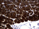 KRT18 Antibody in Immunohistochemistry (Paraffin) (IHC (P))