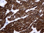 KRT18 Antibody in Immunohistochemistry (Paraffin) (IHC (P))