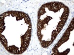 KRT18 Antibody in Immunohistochemistry (Paraffin) (IHC (P))