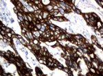 KRT18 Antibody in Immunohistochemistry (Paraffin) (IHC (P))