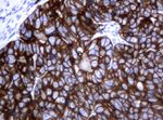 KRT18 Antibody in Immunohistochemistry (Paraffin) (IHC (P))