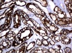 KRT18 Antibody in Immunohistochemistry (Paraffin) (IHC (P))