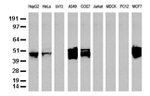 KRT18 Antibody in Western Blot (WB)