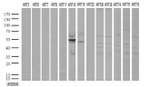 KRT18 Antibody in Western Blot (WB)