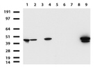 KRT19 Antibody in Western Blot (WB)