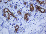 KRT20 Antibody in Immunohistochemistry (Paraffin) (IHC (P))