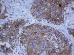 KRT20 Antibody in Immunohistochemistry (Paraffin) (IHC (P))