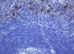 KRT20 Antibody in Immunohistochemistry (Paraffin) (IHC (P))