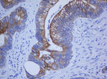 KRT20 Antibody in Immunohistochemistry (Paraffin) (IHC (P))