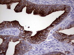 KRT20 Antibody in Immunohistochemistry (Paraffin) (IHC (P))