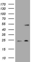 KRT20 Antibody in Western Blot (WB)