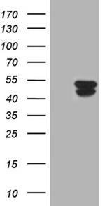 KRT31 Antibody in Western Blot (WB)