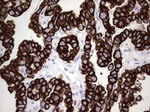 KRT7 Antibody in Immunohistochemistry (Paraffin) (IHC (P))