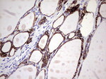 KRT7 Antibody in Immunohistochemistry (Paraffin) (IHC (P))