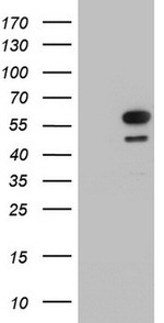 KRT7 Antibody in Western Blot (WB)