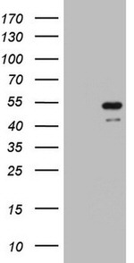 KRT7 Antibody in Western Blot (WB)