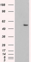 KRT8 Antibody in Western Blot (WB)