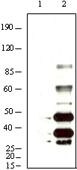 KSHV K8a Antibody in Western Blot (WB)