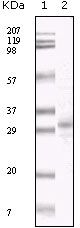 KSHV ORF26 Antibody in Western Blot (WB)