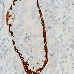 Cytokeratin 6 Antibody in Immunohistochemistry (Paraffin) (IHC (P))