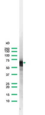 Cytokeratin 6 Antibody in Western Blot (WB)