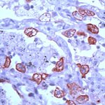 Cytokeratin 8 Antibody in Immunohistochemistry (IHC)