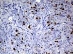 Ki67 Antibody in Immunohistochemistry (Paraffin) (IHC (P))