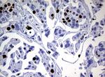 Ki67 Antibody in Immunohistochemistry (Paraffin) (IHC (P))