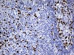 Ki67 Antibody in Immunohistochemistry (Paraffin) (IHC (P))