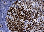 Ki67 Antibody in Immunohistochemistry (Paraffin) (IHC (P))