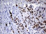 Ki67 Antibody in Immunohistochemistry (Paraffin) (IHC (P))