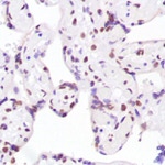 Ku80 Antibody in Immunohistochemistry (IHC)