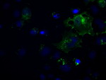 L1CAM Antibody in Immunocytochemistry (ICC/IF)