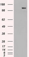 L1CAM Antibody in Western Blot (WB)