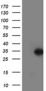 LACTB2 Antibody in Western Blot (WB)
