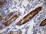 LAD1 Antibody in Immunohistochemistry (Paraffin) (IHC (P))