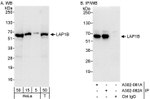 LAP1B Antibody in Western Blot (WB)