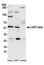 LAP2 beta/TMPO Antibody in Western Blot (WB)