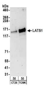 LATS1 Antibody in Western Blot (WB)