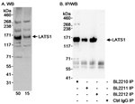 LATS1 Antibody in Western Blot (WB)